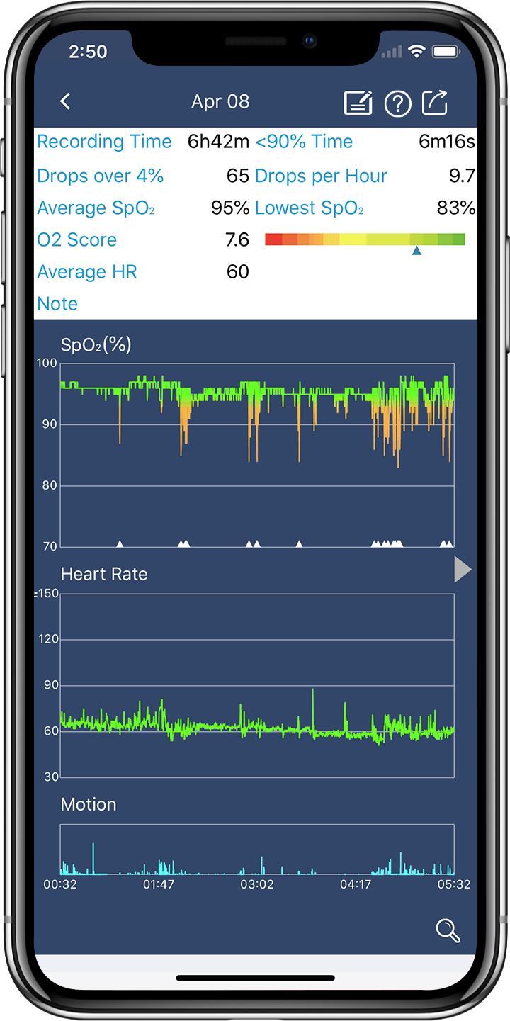 Interpreting Overnight Oximetry Readings Health