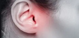 Ear Infections and Hearing Loss