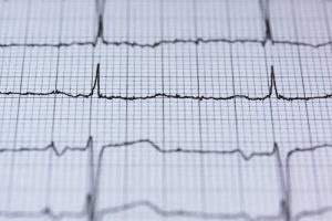 How to calculate your Pulse Correctly?