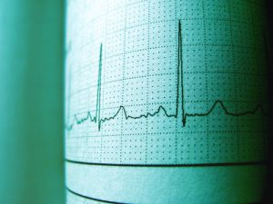 Cardiogram readings. ECG meanings