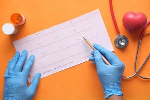 Cardiogram readings. ECG meanings